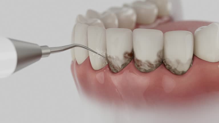 Reliable Dental Implants contractor in Cary, NC by Smile Center Dentistry